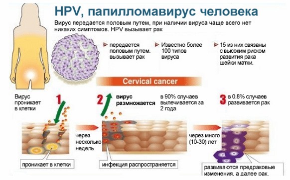 HPV bij vrouwen - wat is het, symptomen, soorten, hoe wordt het overgedragen, behandeling van humaan papillomavirus in de gynaecologie