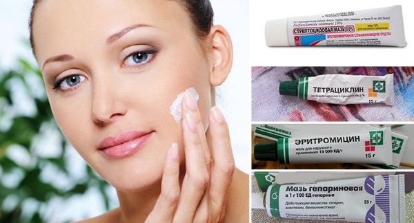 Tetracycline zalf voor acne op het gezicht. Instructies voor gebruik, foto's, recensies, prijs