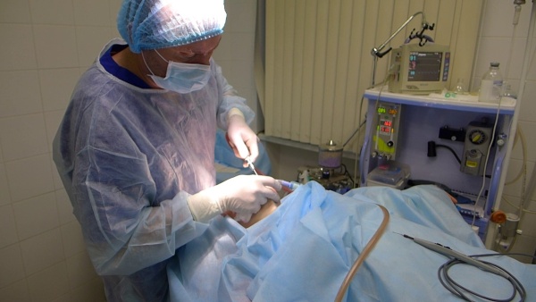 Liposuction dagu dengan laser. Foto, bagaimana prosedur dijalankan, tempoh pemulihan, akibatnya, ulasan