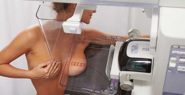 Pembedahan pembesaran payudara. Foto kanak-kanak perempuan dengan payudara besar, hasil, kemungkinan komplikasi