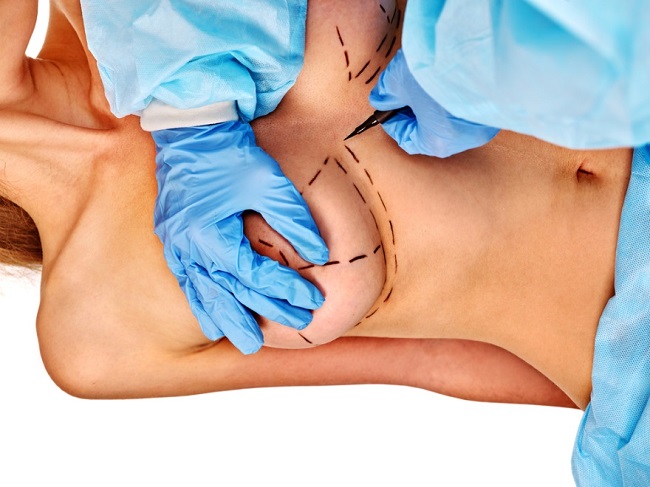 Πού να πάρετε πλαστική χειρουργική μαστού. Τιμές, κριτικές, φωτογραφίες πριν και μετά