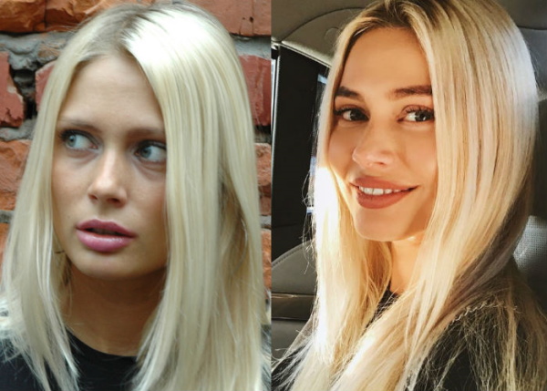 Natalia Rudova sebelum dan selepas pembedahan plastik, gambar panas dalam pakaian renang, biografi