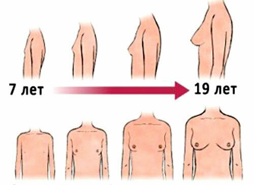 Vad ska jag göra för att bröstet ska växa snabbare för en tjej under 18 år?