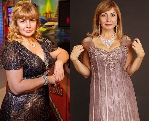 Irina Agibalova. Photos avant et après la chirurgie, perte de poids