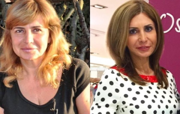 Irina Agibalova. Photos avant et après la chirurgie, perte de poids