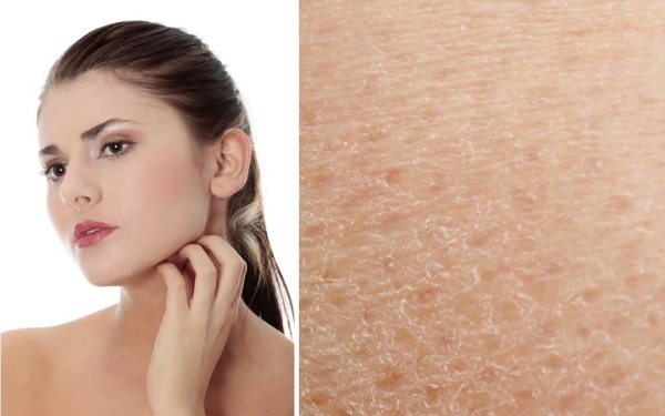 Jenis kulit dalam kosmetologi. Klasifikasi, kriteria penentuan, foto
